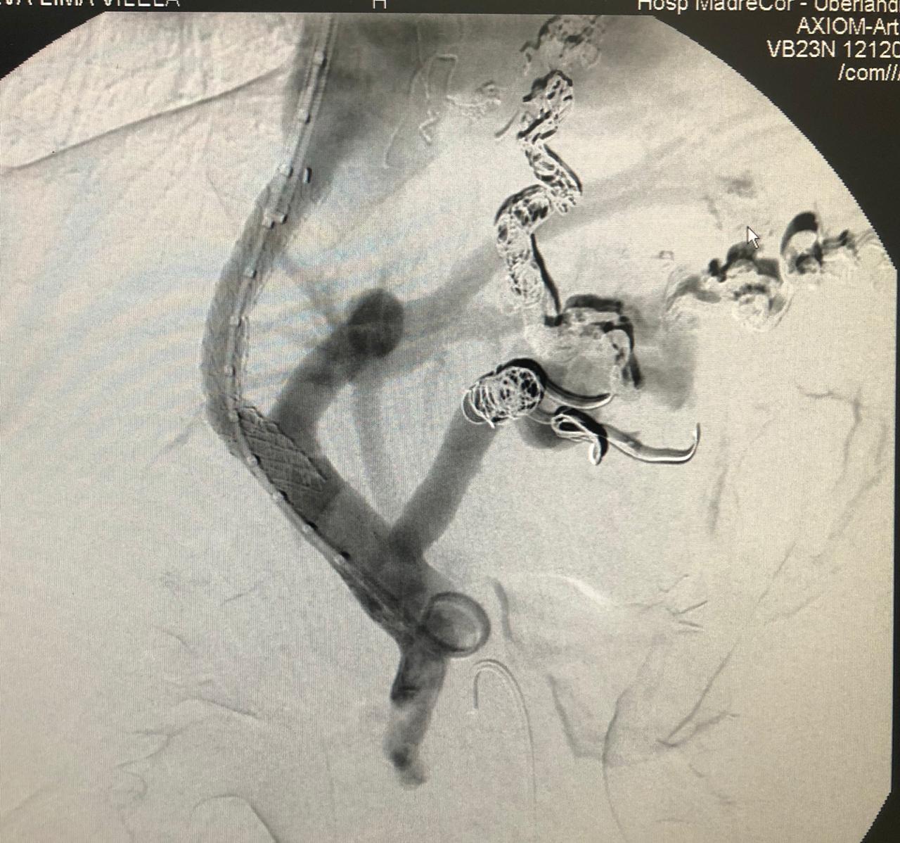 Procedimento médico é feito de forma inédita em Uberlândia-MG