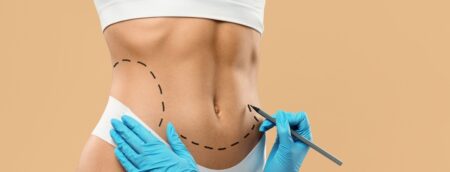 Beleza natural é foco da cirurgia plástica em 2025 Beleza natural é foco da cirurgia plástica em 2025