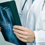 BH recebe mutirão de exames que detectam doenças pulmonares obstrutivas - Foto: Divulgação/Depositphotos
