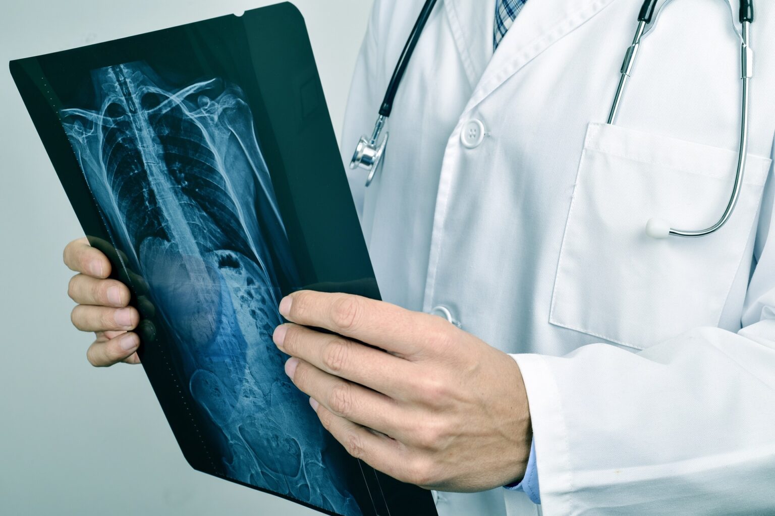 BH recebe mutirão de exames que detectam doenças pulmonares obstrutivas - Foto: Divulgação/Depositphotos