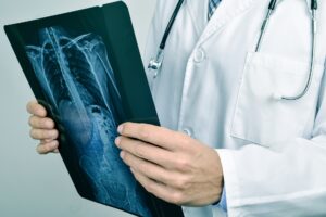 BH recebe mutirão de exames que detectam doenças pulmonares obstrutivas - Foto: Divulgação/Depositphotos