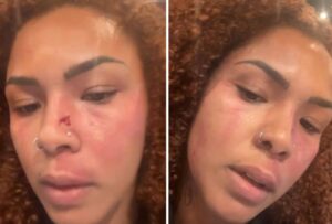 Ex-funcionária acusa gerente de academia de agressão em BH - Foto: Reprodução/Redes Sociais