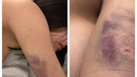 Polícia Civil indicia homem por estupro e agressões contra influenciadora em Nova Lima - Foto: Reprodução