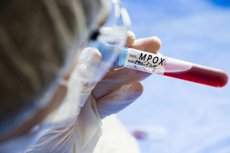 Minas Gerais registra sete casos de Mpox em 2026 Minas Gerais registra sete casos de Mpox em 2026 - Foto: Divulgação/Depositphotos