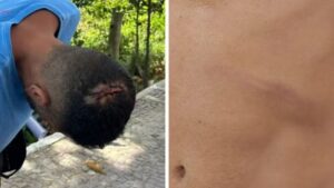 Turista mineiro denuncia agressão em praia de Vila Velha, no Espírito Santo - Foto: Reprodução/Redes Sociais