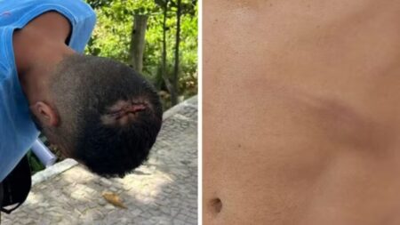 Turista mineiro denuncia agressão em praia de Vila Velha, no Espírito Santo - Foto: Reprodução/Redes Sociais