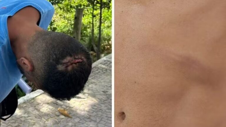 Turista mineiro denuncia agressão em praia de Vila Velha, no Espírito Santo - Foto: Reprodução/Redes Sociais