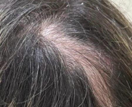 Enfermeiro despeja gasolina sobre madrasta e tenta atear fogo na Grande BH - Foto: Divulgação/PCMG