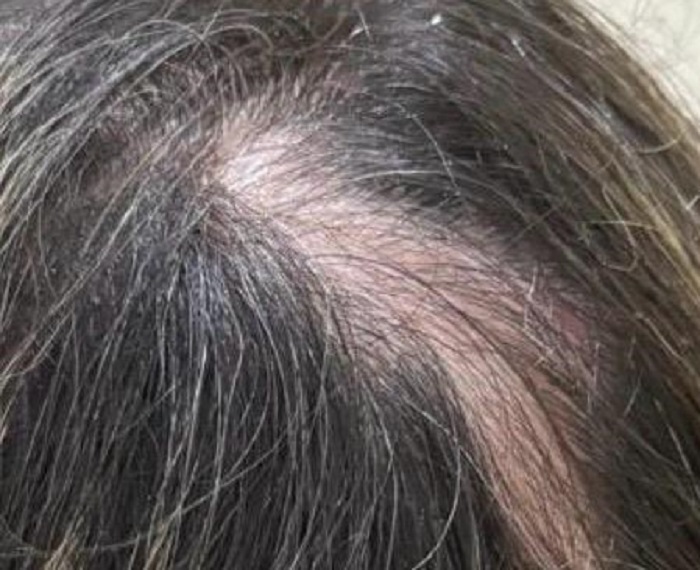 Enfermeiro despeja gasolina sobre madrasta e tenta atear fogo na Grande BH - Foto: Divulgação/PCMG