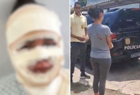Fisioterapeuta é presa suspeita de jogar água fervendo em mulher em BH Fisioterapeuta é presa suspeita de jogar água fervendo em mulher em BH - Foto: Divulgação/PCMG