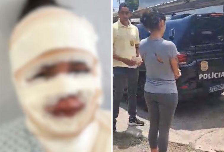 Fisioterapeuta é presa suspeita de jogar água fervendo em mulher em BH Fisioterapeuta é presa suspeita de jogar água fervendo em mulher em BH - Foto: Divulgação/PCMG